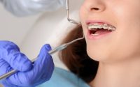 Tips To Maintain Oral Hygiene With Orthodontic Treatment